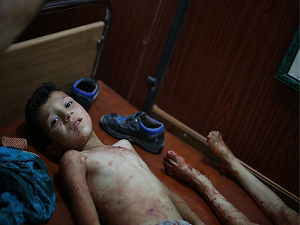 Doğu Guta'da tıbbi malzeme ihtiyacı had safhada