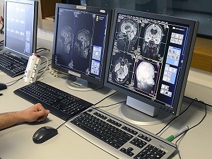 Türk bilim ekibi beynin sırlarını çözme yolunda