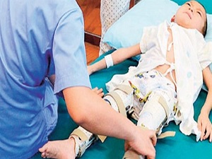 3 boyutlu yazıcıyla ameliyat