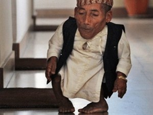 Dünyanın en kısa adamı öldü
