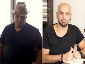 'Gastrik by-pass' ameliyatı ile 90 kilo verdi