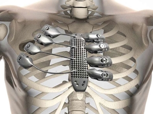 Tıp alanında bir ilk gerçekleştirildi