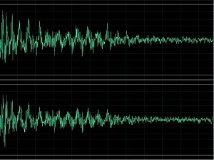 Bilim adamları ses dalgalarıyla beyni kontrol etti