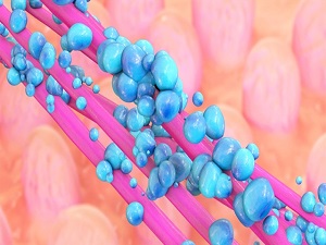 Bağırsak kanseri hemoroid ile karıştırılabiliyor!