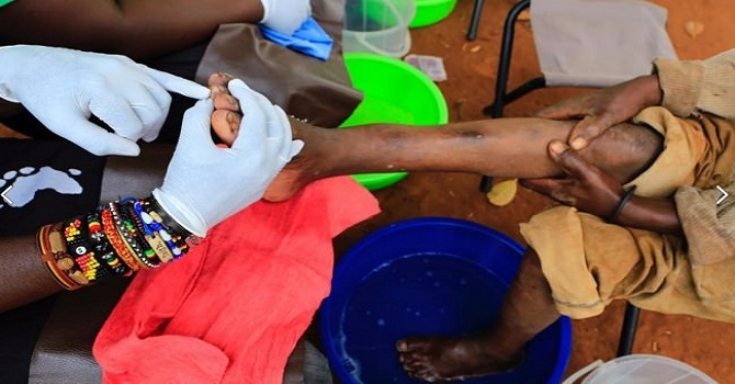 Doğu Ugandanın ölümcül imtihanı