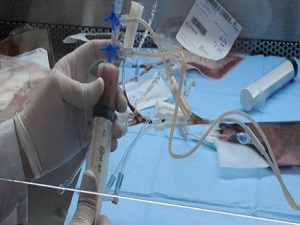 Bursa'da kök hücre nakilleri 6 yıldır devam ediyor