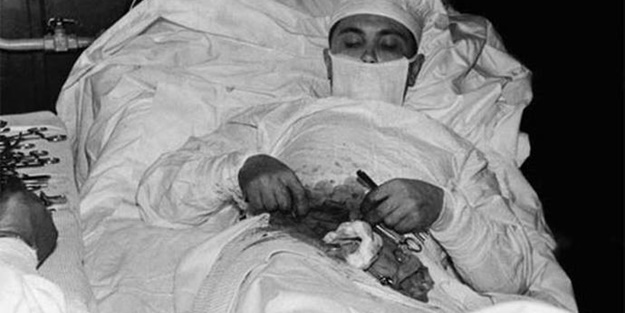 Kendi kendini ameliyat etmişti