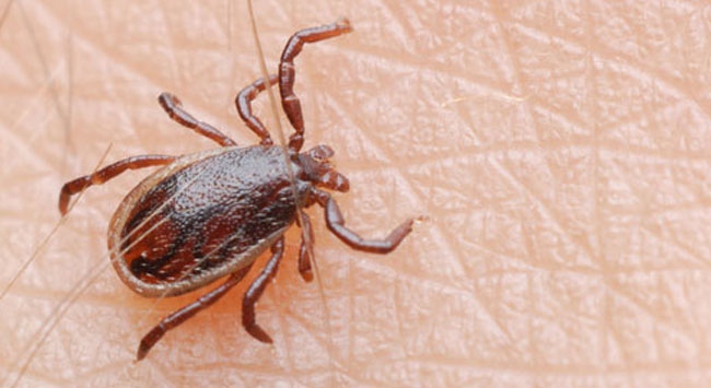 KKKA hastalığında genler araştırılacak