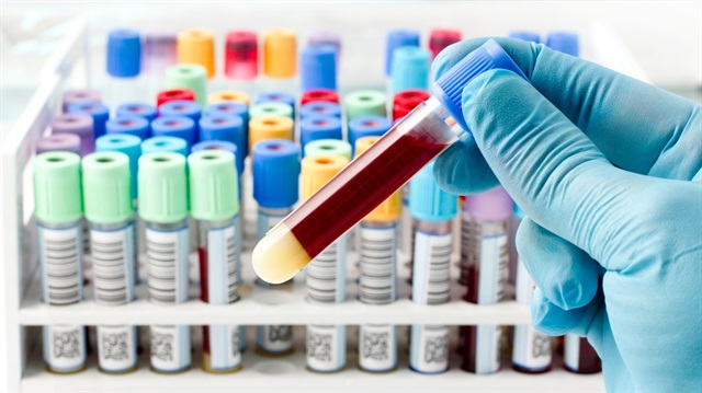 Türk Kızılayı kan bağışı hedefini tutturacak