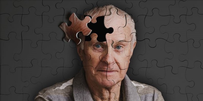 Alzheimer'ın yıllar öncesinden teşhis edilebileceği ileri sürüldü