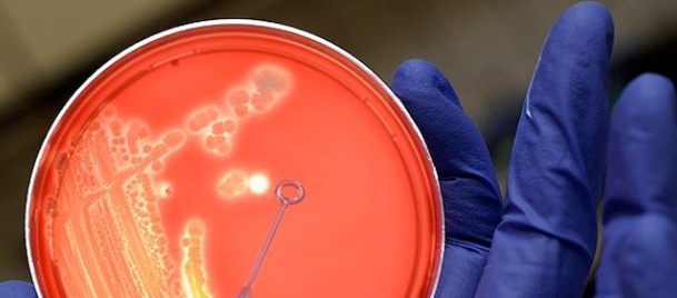 Dünyada 1,5 milyon kişi bu hastalık sebebiyle öldü