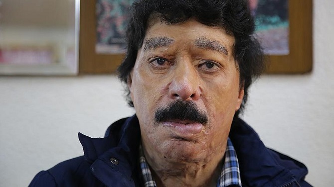 Yeni yüzüne kavuşmak istiyor