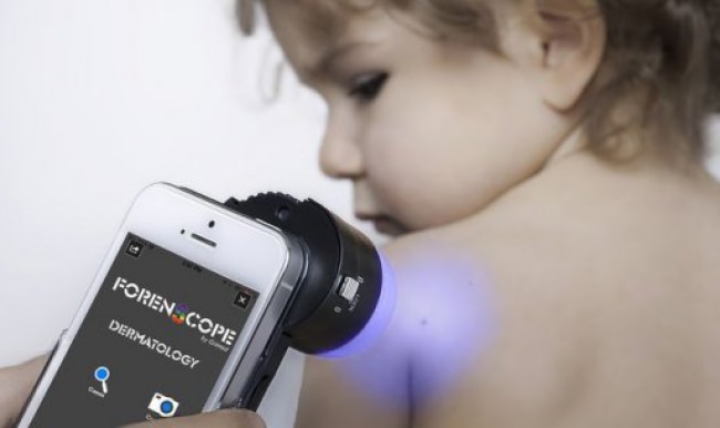 Cep telefonundan cilt kanseri teşhisi!