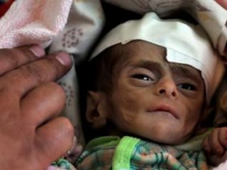 500 bin çocuğun hayatı tehlikede