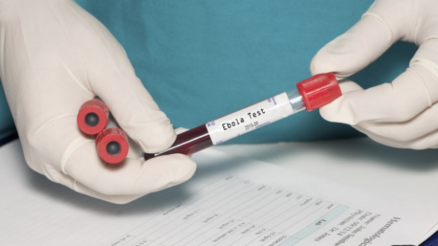 TİKA'dan Gine-Bissau'ya ebola mücadelesi için destek