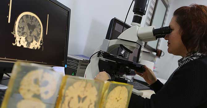 Alzaymırın gizemi 'Beyin Bankası'nda çözülecek