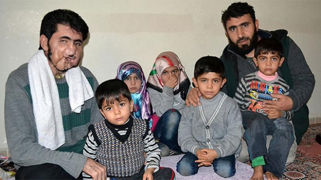 Savaşta kaybettiği yüzünü geri istiyor