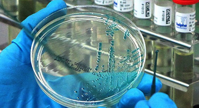 H1N1 virüsü 2 saat canlı kalabilir