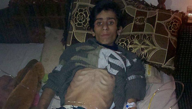 Madaya'da açlıktan ölümler sürüyor
