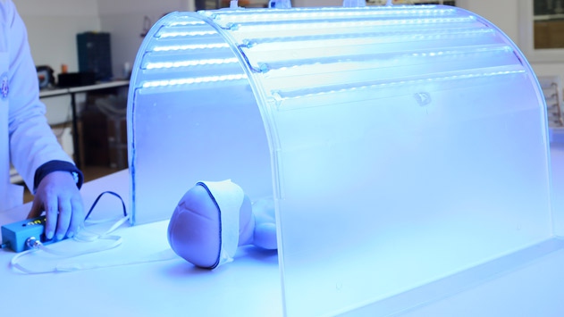 Ev tipi sarılık cihazı ürettiler