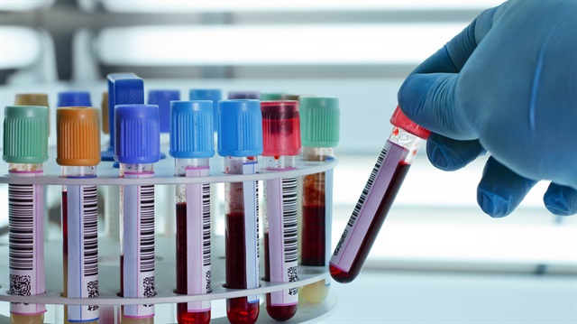 Ukrayna'da 220 kişi bu hastalıktan öldü