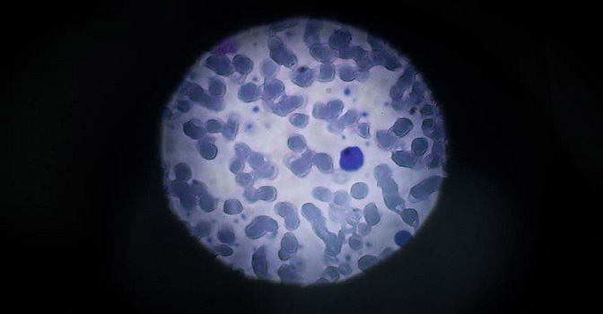 Çin'de Zika virüsü vakasına rastlandı