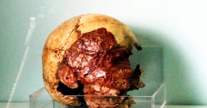 7 bin 200 yıllık kafatası