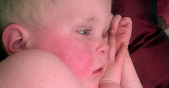 Kızıl hastalığı geri döndü