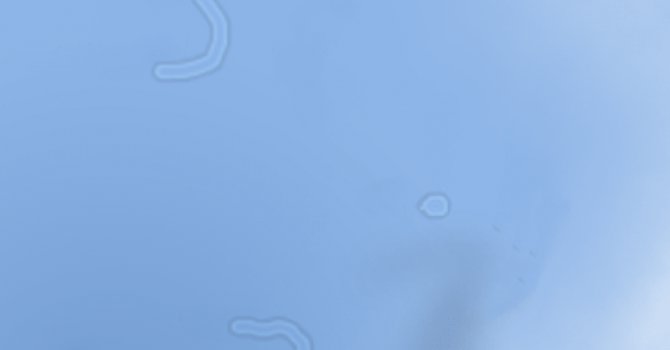 Gözümüzü kapattığımızda "Bu Noktaları" neden görüyoruz?