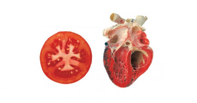 Sebze ve Meyvelerin iyi geldiği organlar arasındaki benzerliği biliyor musunuz?
