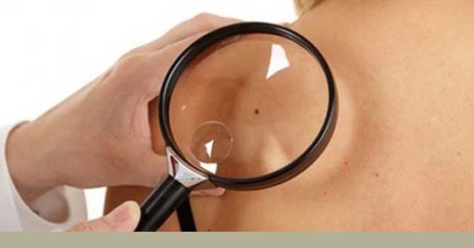 'Cilt hastalıklarının kökeni psikolojik olabilir'