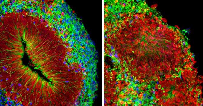Bir çok ölüme sebep olan virüsün çözümü 16 yaşındaki mucitte!