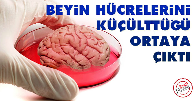 Beyin hücrelerini küçülttüğü ortaya çıktı