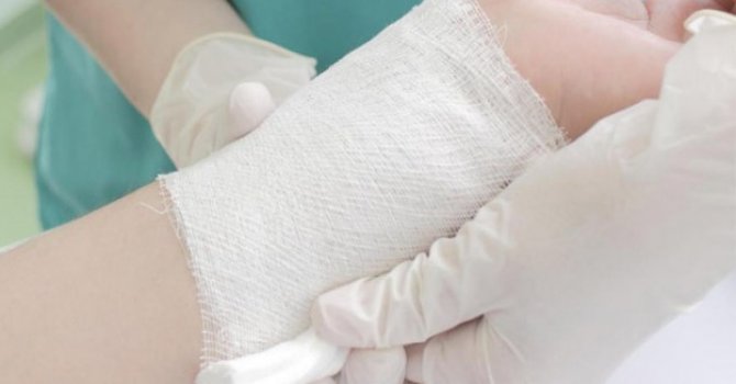 Yanıklara ne sürmemiz gerekiyor?