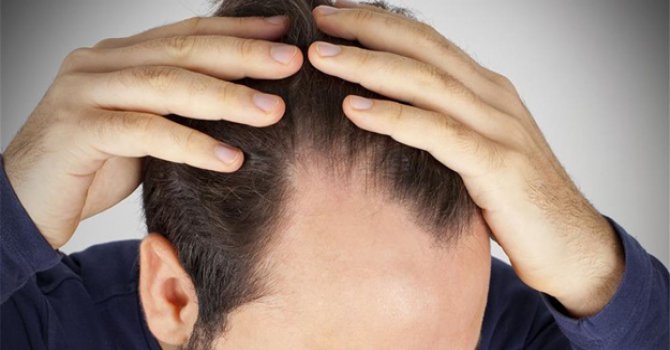 Kışa kadar saçınıza dikkat