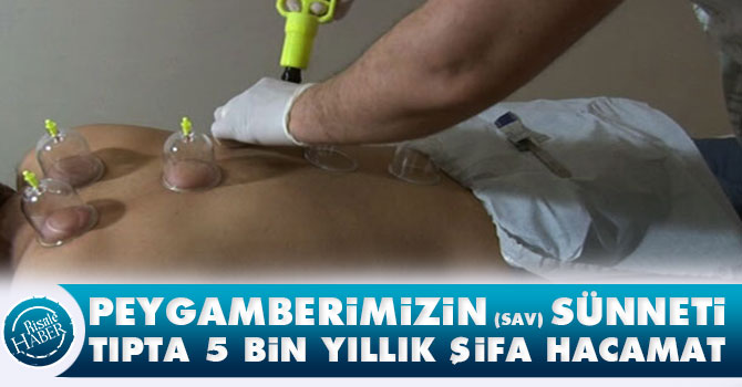 Peygamberimizin sünneti, tıpta 5 bin yıllık şifa hacamat