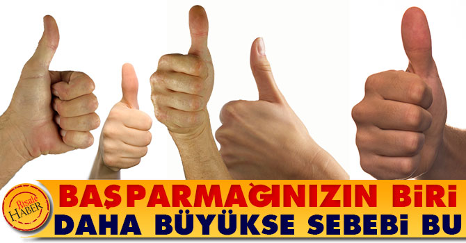 Başparmağınızın biri daha büyükse nedeni bu