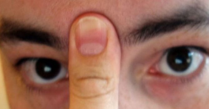 Tıkalı burun uykusuzluk sebebi