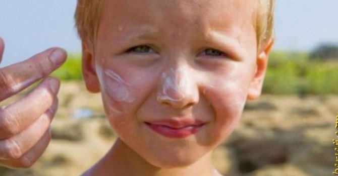 Güneş Yanığı Kansere neden olur mu?