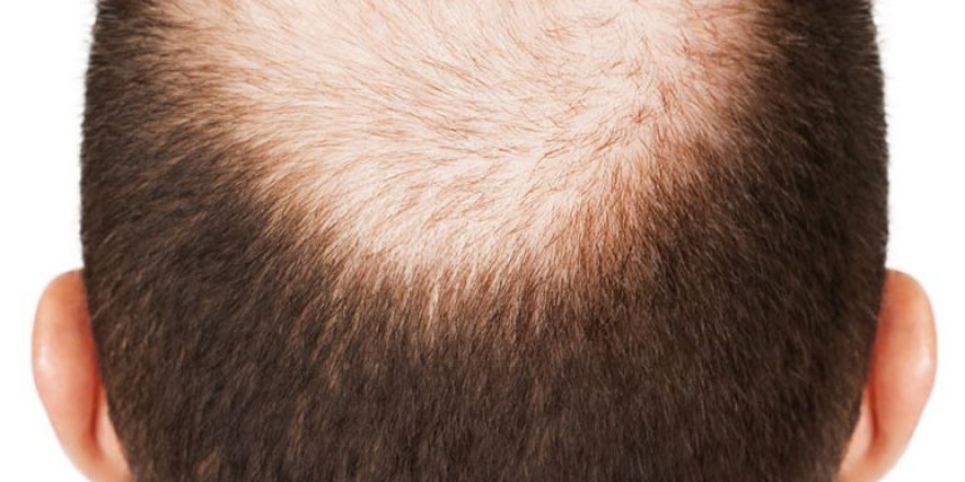 Kellik tamamen tarihe karışıyor