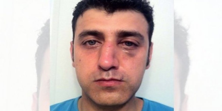 Türkçe konuştuğu için bu hale soktular!