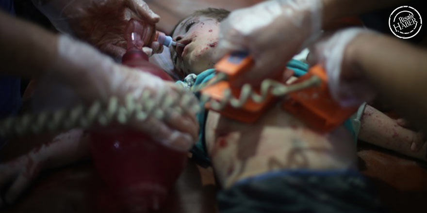 İslâm'da ölünün cesedini yakmak haram mı?