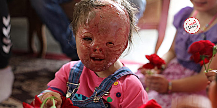 Savaşın en büyük acılarını yaşayan Suriyeli çocukların dramı