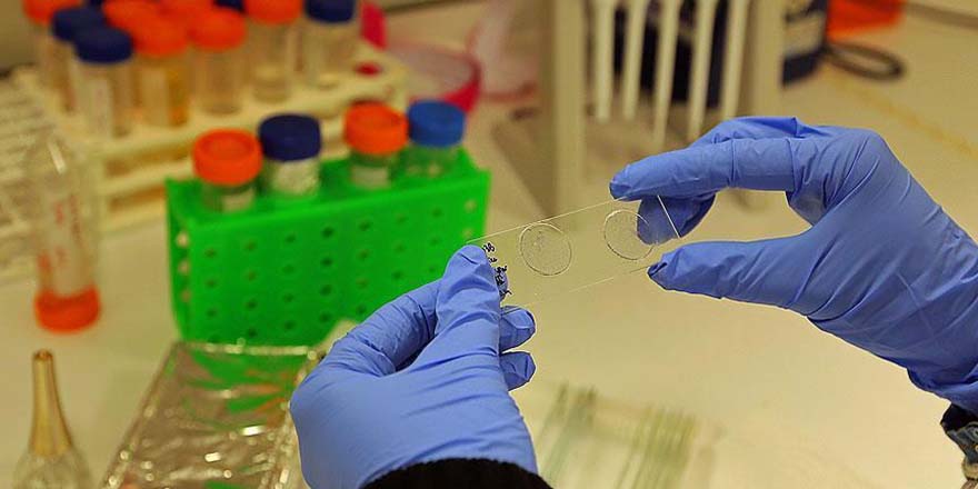 Çiftlere evlilik öncesi 'genetik geçişli hastalıklar' için tarama
