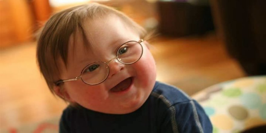 Otizm spektrum bozukluğu erken yaşlarda fark edilmeli