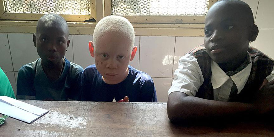 Afrika, 'gizli utancı' bu çocukları konuşuyor