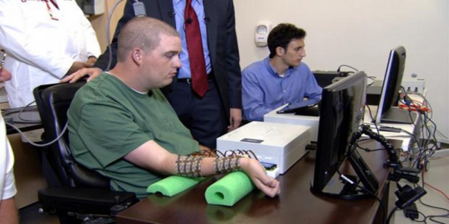 Gençlerde felç geçirme oranı artarken yaşlılarda azalıyor