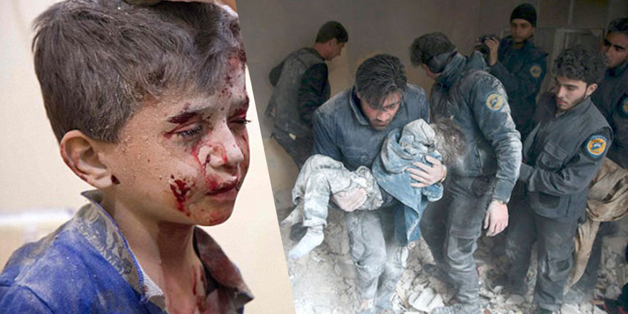 Küçük Ammar'ın feryadı: Halep'te çocukların cesetleri kömür oldu!