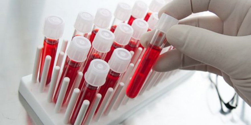 Kan testiyle kalp krizi riski belirlenebiliyor