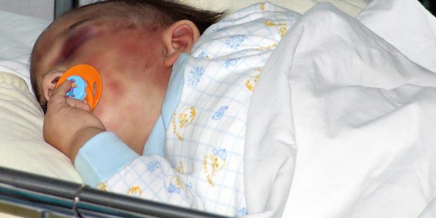 Bebeği şiddetle sarsmak ölüme neden olabilir